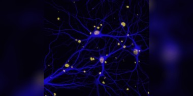 alzheimer banner